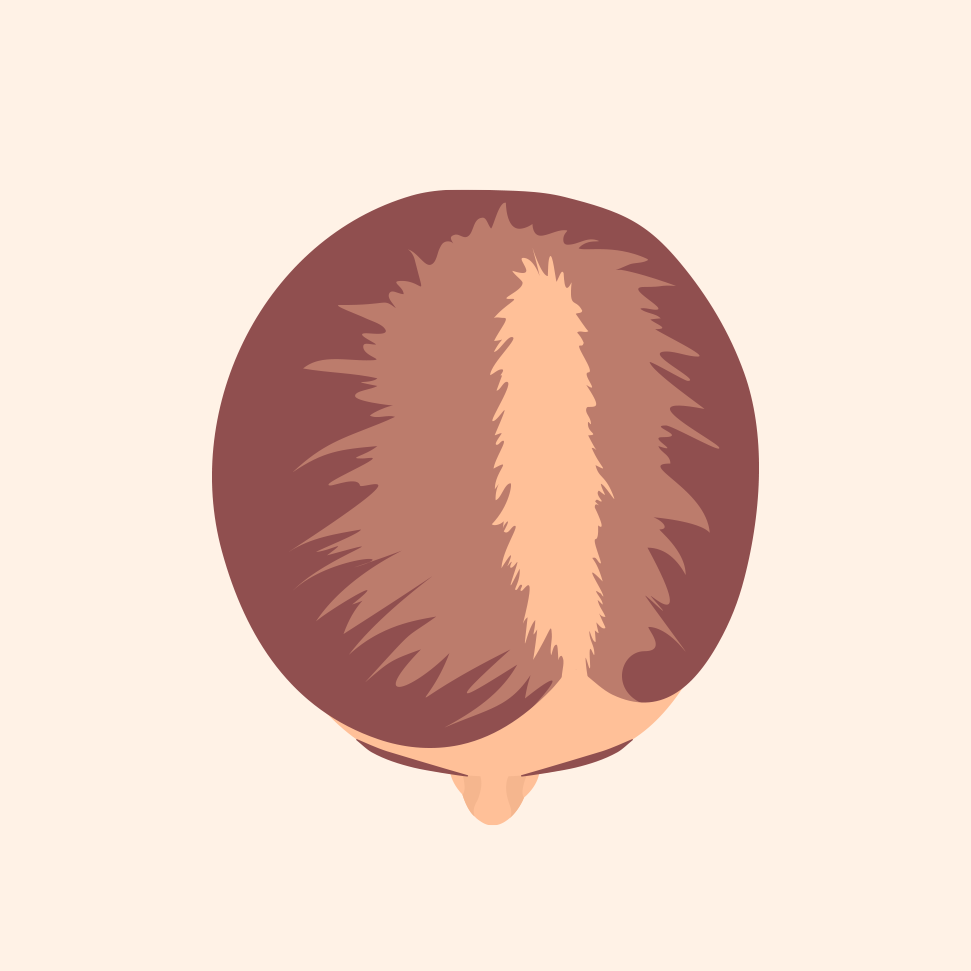 Stage 2