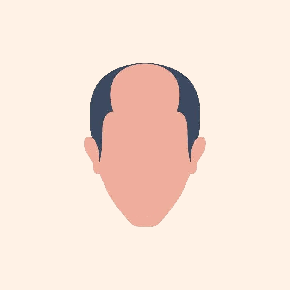 Stage 5