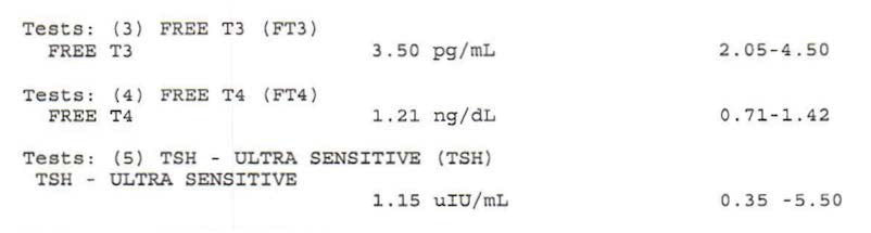 Thyroid Panel As A Vegan Experiencing Hair Loss