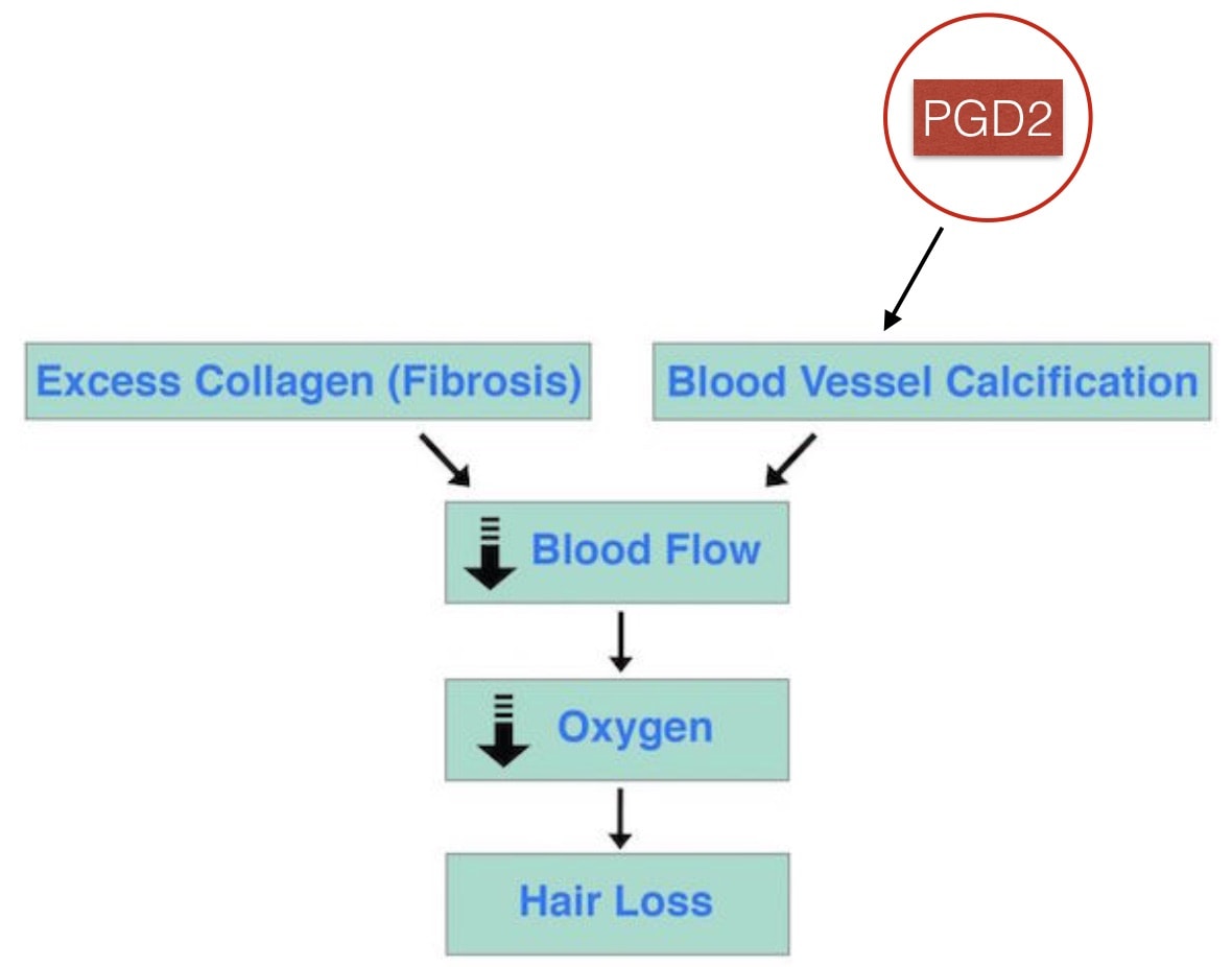 Prostaglandin D2 Calcification Hair Loss