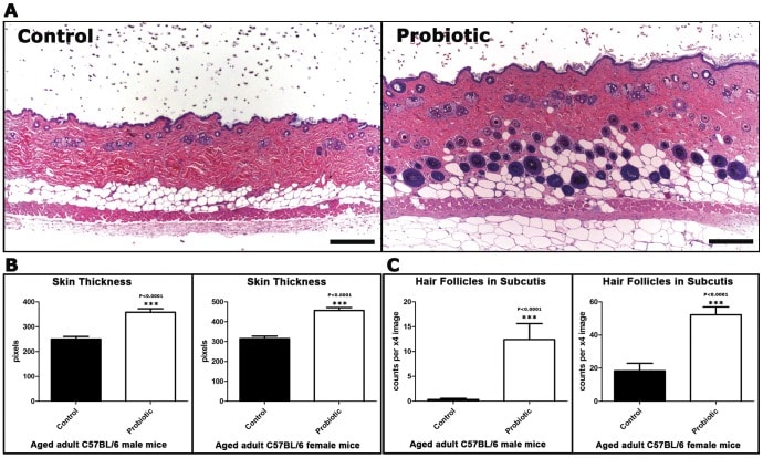 FLORACIL50: Probiotic With Lactobacillus Rhamnosus and Reuteri