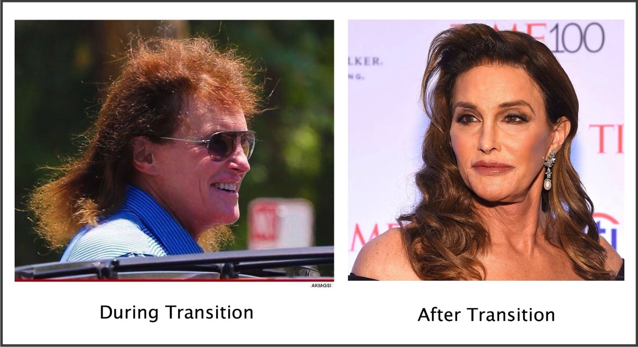 Mtf Hrt Body Changes Timeline