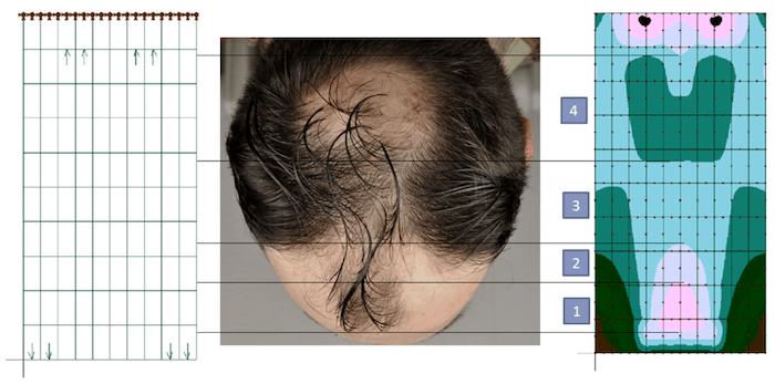 Scalp Tension and Hair Loss A Scientific Breakdown