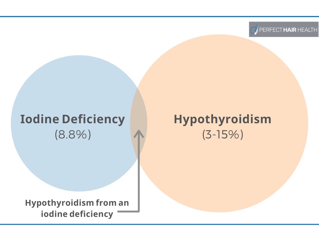 health benefits of iodine supplements