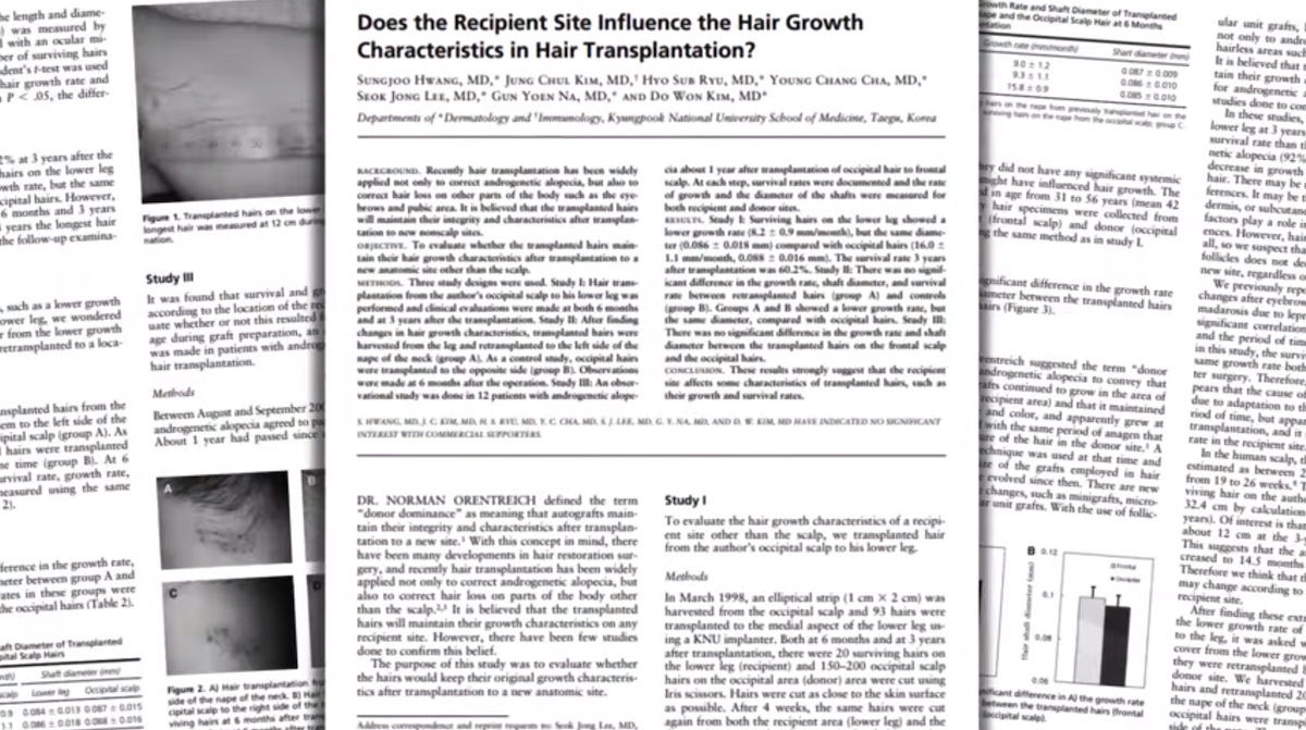 Study of recipient site influence on hair transplants