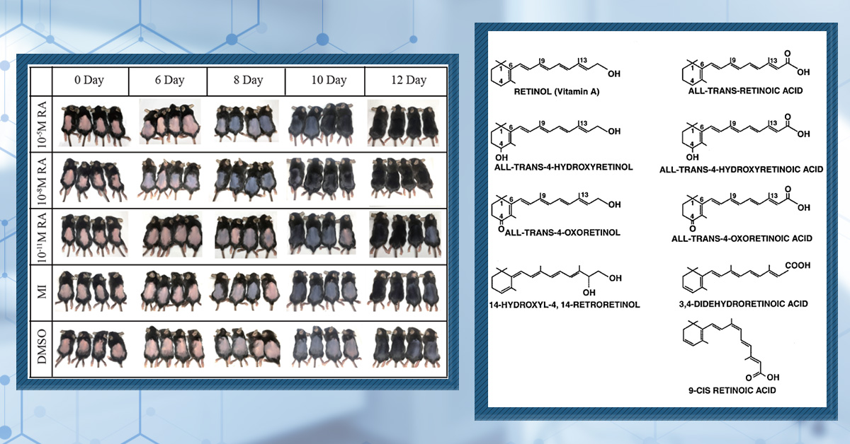 Does Retinoic Acid (Tretinoin) Improve Hair Growth From Minoxidil?