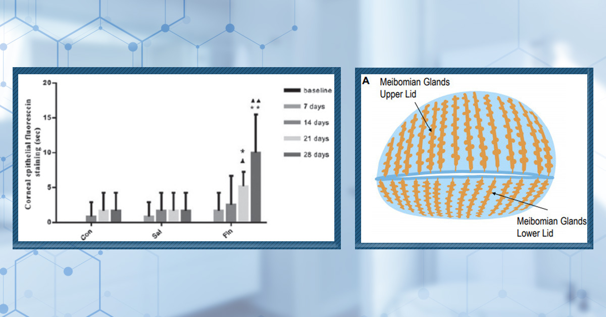 Finasteride and Dry Eye Disease: Is There A Connection?