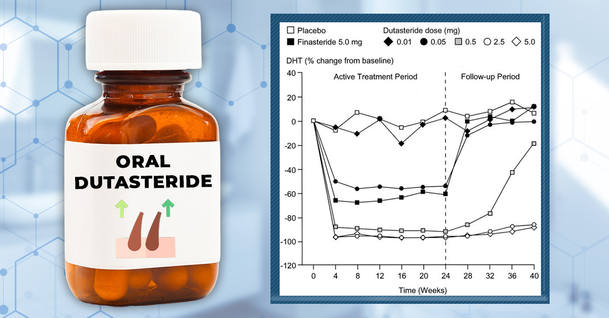Oral Dutasteride for Hair Loss: Results, Side Effects, Dosing & How It Compares to Finasteride