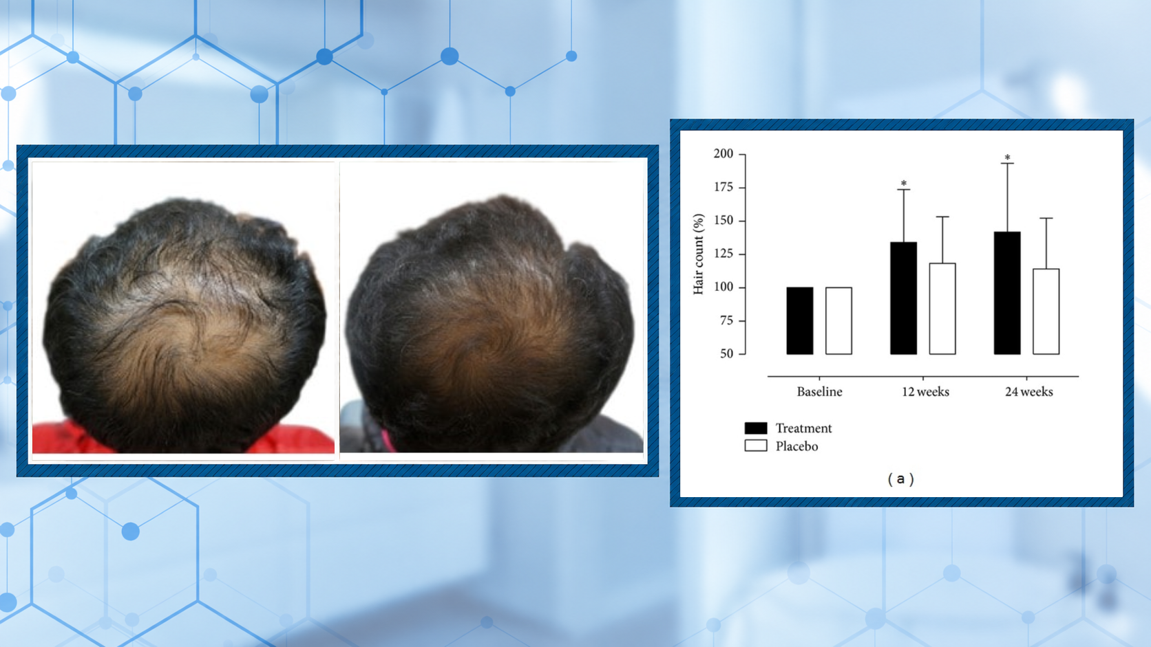 Pumpkin Seed Oil for Hair Growth: Before and After Photos