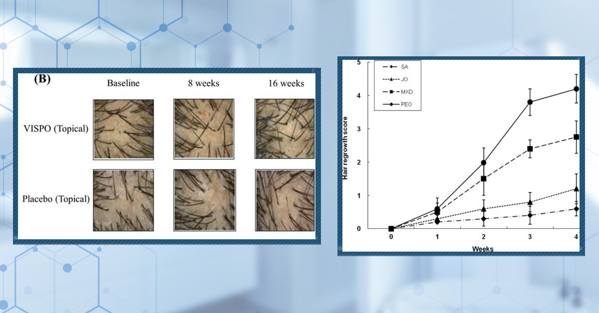 7 Best Oils for Hair Growth