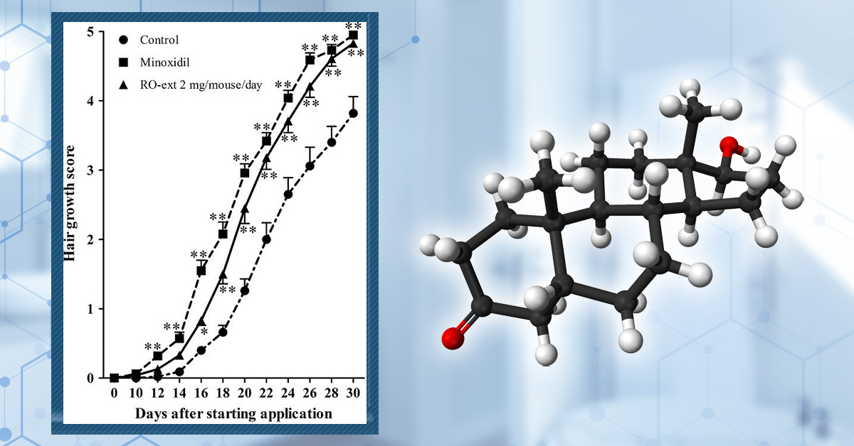 10 Best DHT-Blocking Shampoos