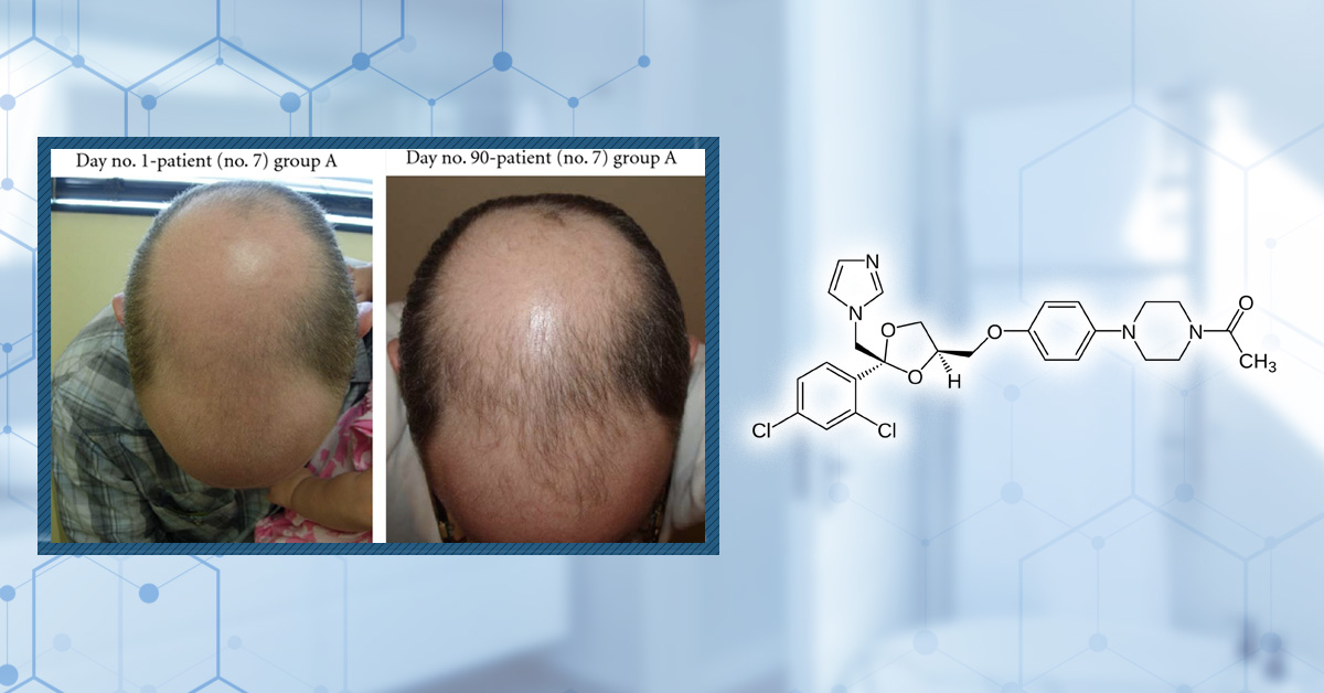 10 Best Shampoos for Hair Loss in 2026