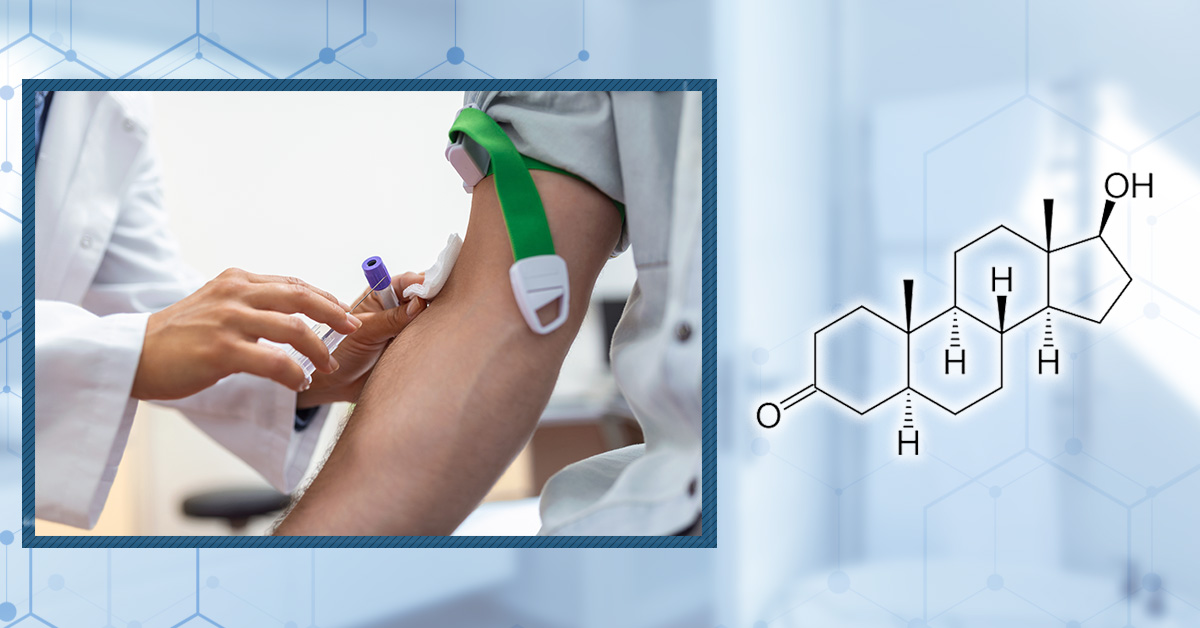 Can a Blood DHT Test Tell You Whether You Have AGA?