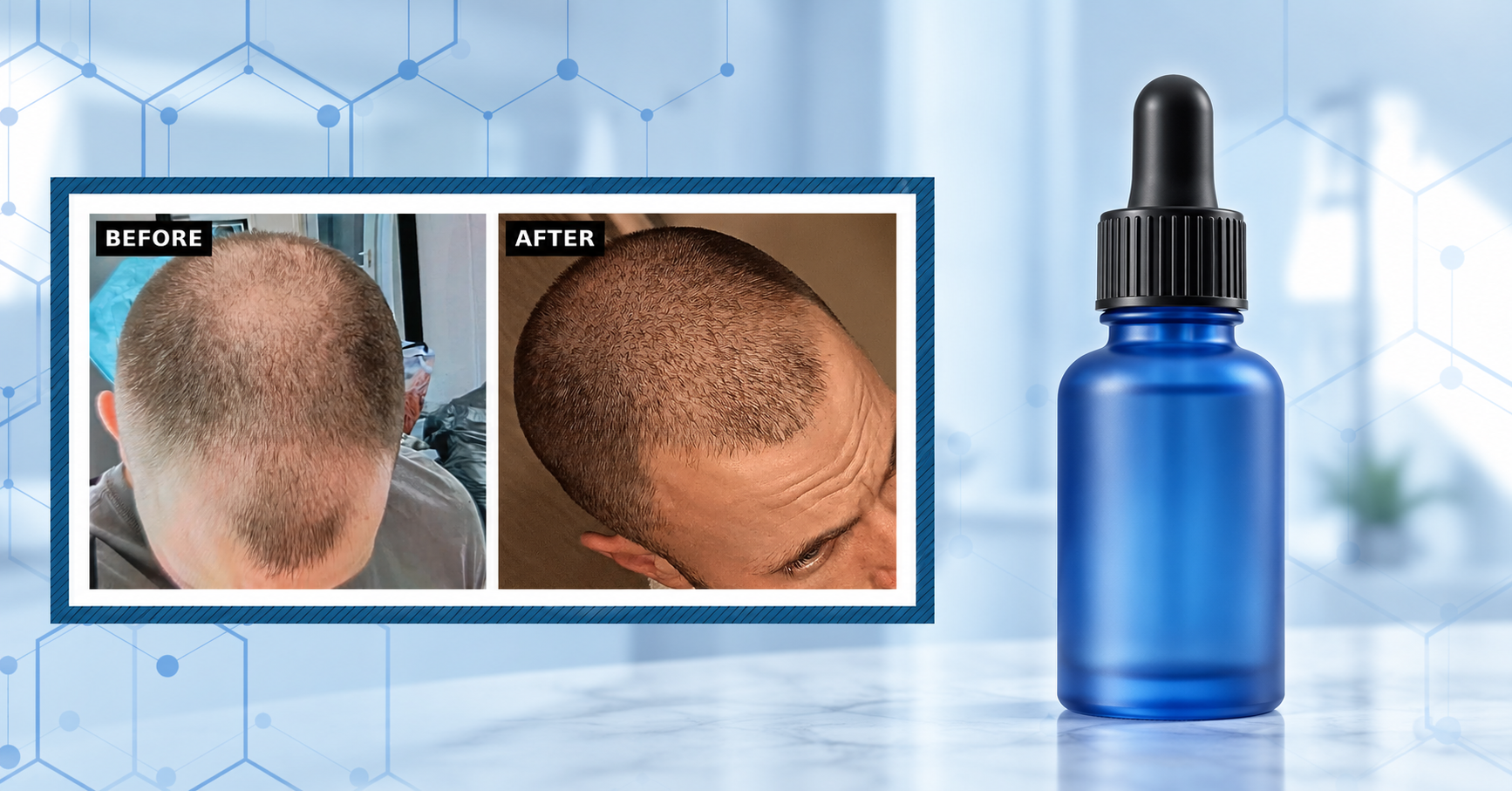 GHK-Cu for Hair Growth: Does It Actually Work?